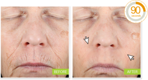 Miracle Wrinkle Filler