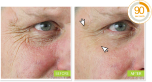 Miracle Wrinkle Filler